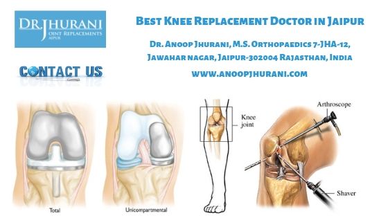 Best Knee Replacement Doctor in Jaipur Total Knee Replacement surgeon