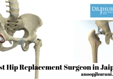 Best Hip Replacement Surgeon in Jaipur Orthopaedic Surgeon Knee Joint Surgery